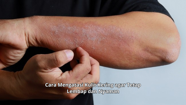 Cara Mengatasi Kulit Kering