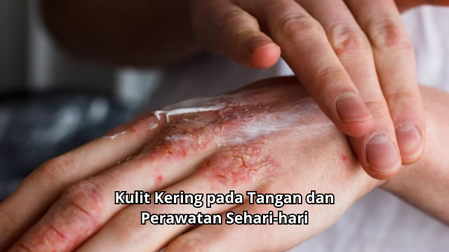 Kulit Kering pada Tangan
