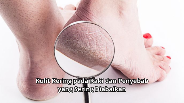 Kulit Kering pada Kaki