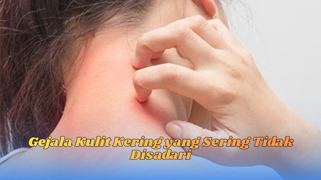 gejala kulit kering