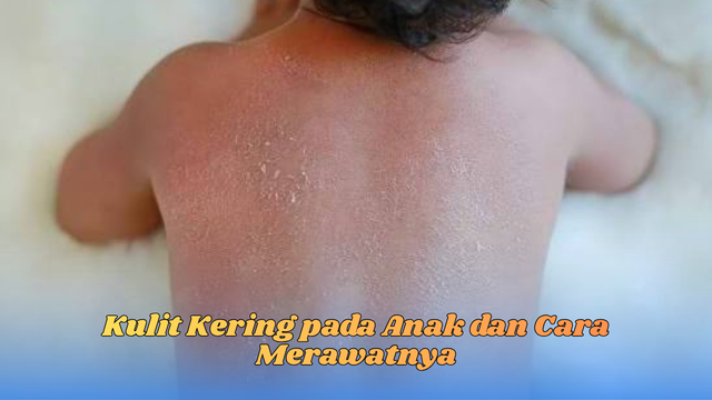 kulit kering pada anak